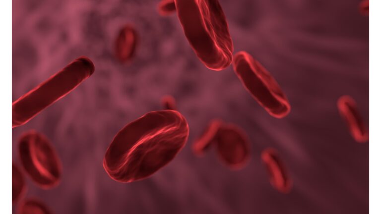Anemia overview.
