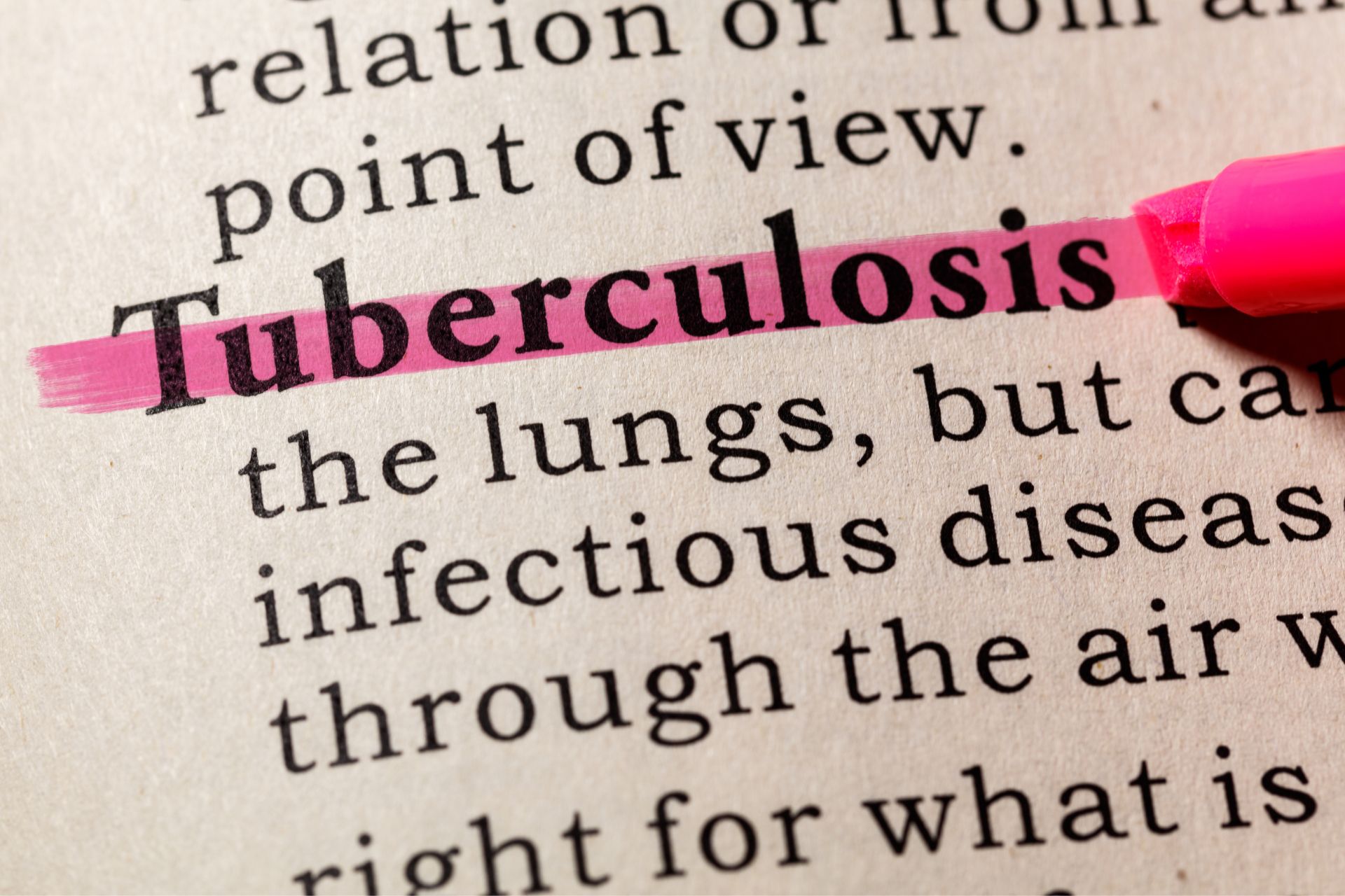Tuberculosis: Management of Drug-Resistant TB.